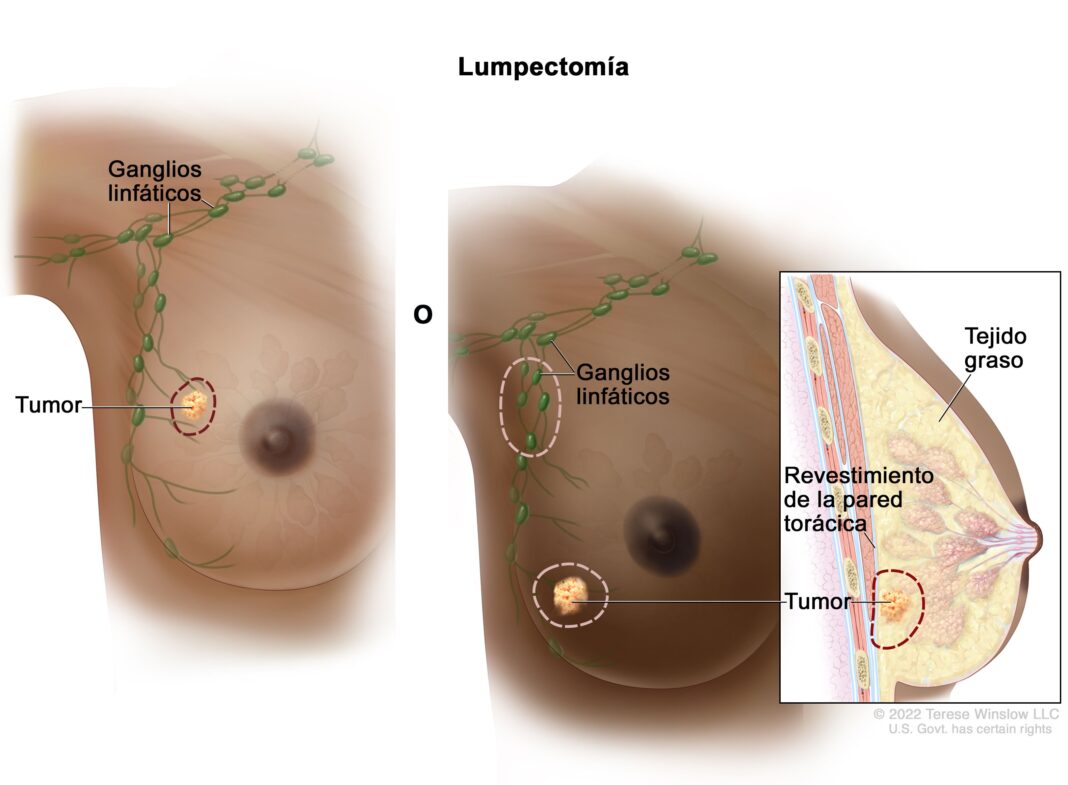 El cáncer de mama sigue siendo la principal causa de muerte oncológica en mujeres El cáncer de mama sigue siendo la principal causa de muerte oncológica en mujeres